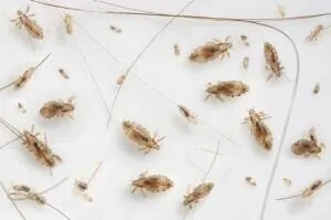 Close-up photo of head lice and nits on hair strands